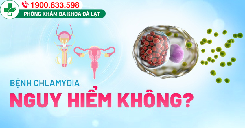 Hình ảnh minh họa