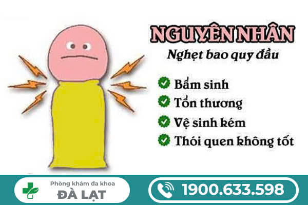 Hình ảnh minh họa