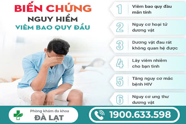 Hình ảnh minh họa