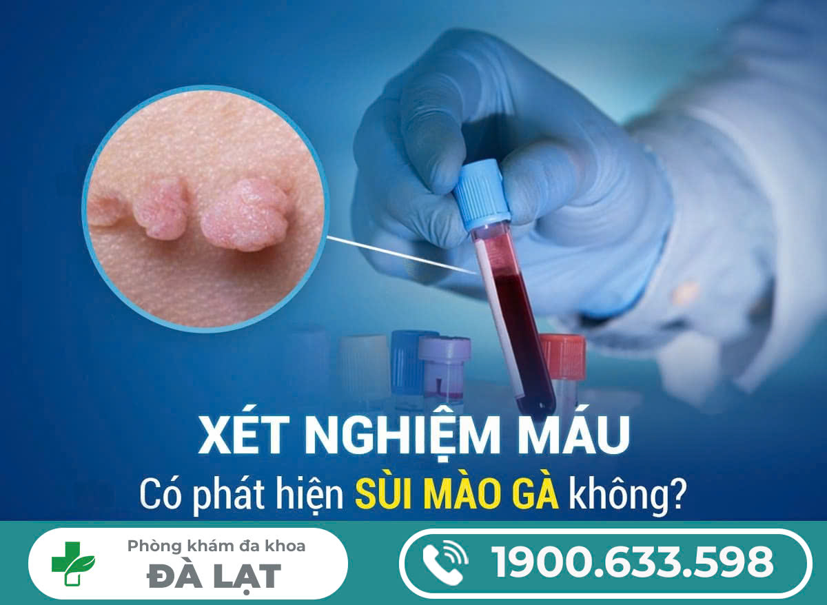 Hình ảnh minh họa