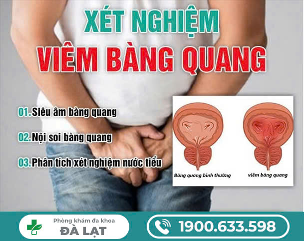 Hình ảnh minh họa