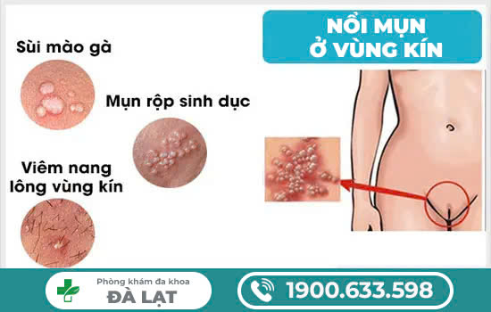 Hình ảnh minh họa