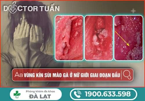 Hình ảnh minh họa