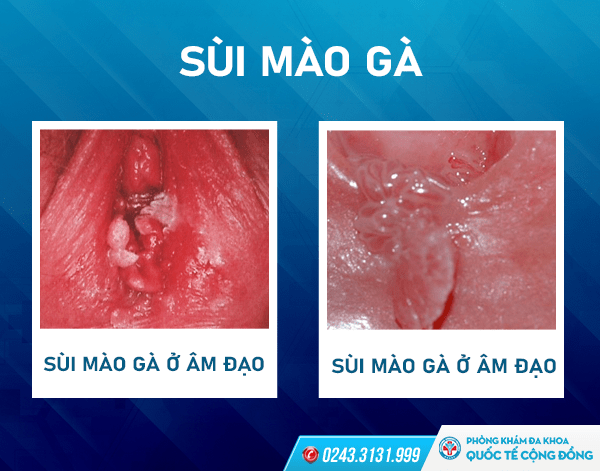 Hình ảnh minh họa