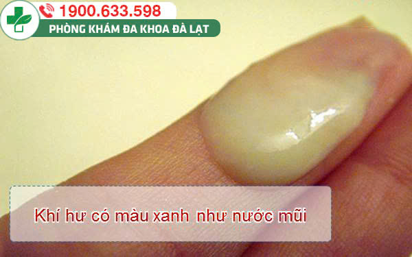 Hình ảnh minh họa