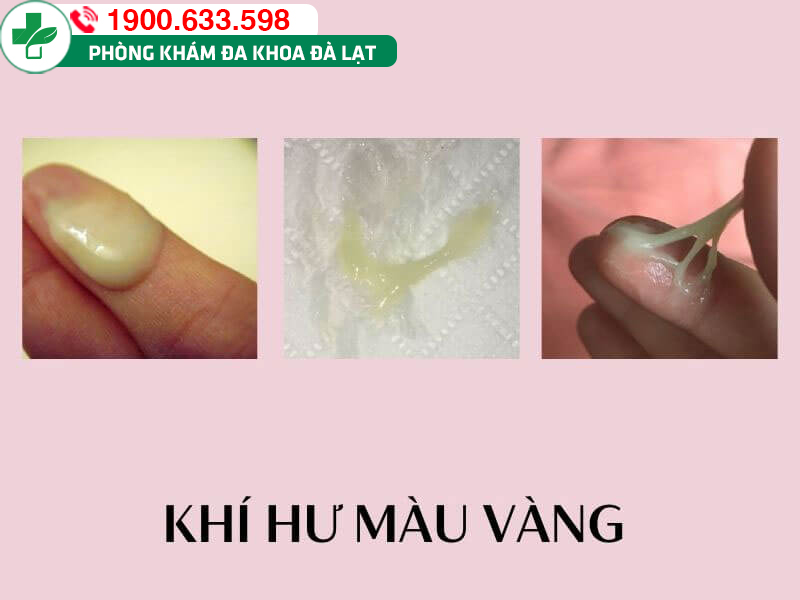 Hình ảnh minh họa