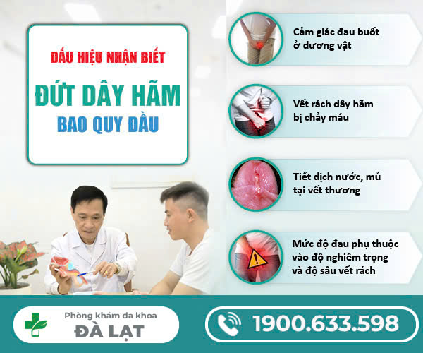 Hình ảnh minh họa