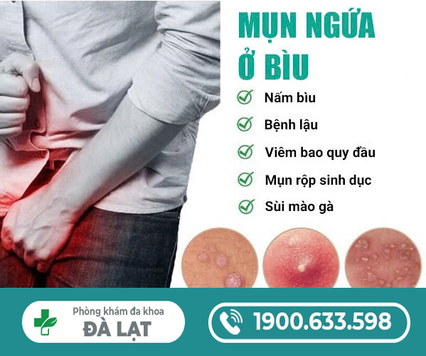 Hình ảnh minh họa