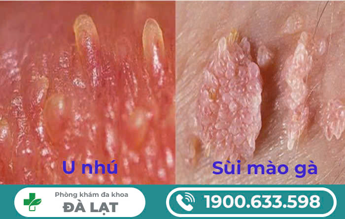Hình ảnh minh họa