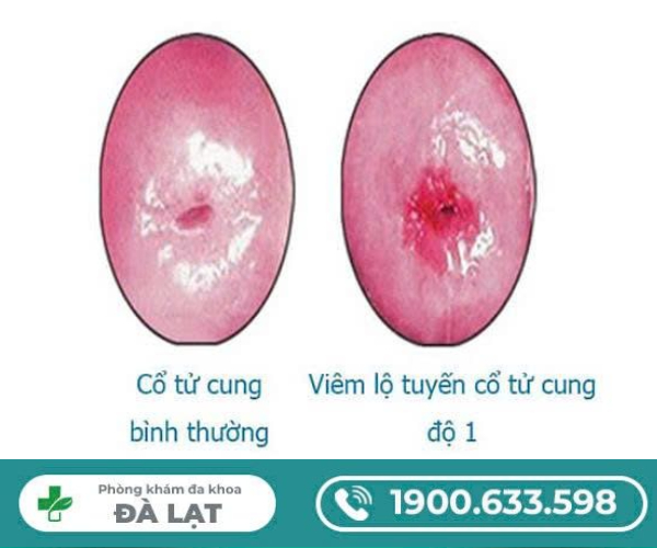 Hình ảnh minh họa