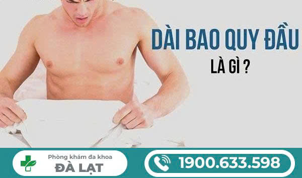 Hình ảnh minh họa