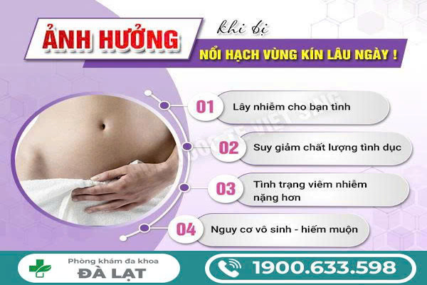 Hình ảnh minh họa