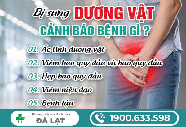 Hình ảnh minh họa
