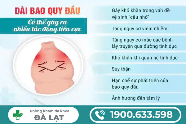 Hình ảnh minh họa
