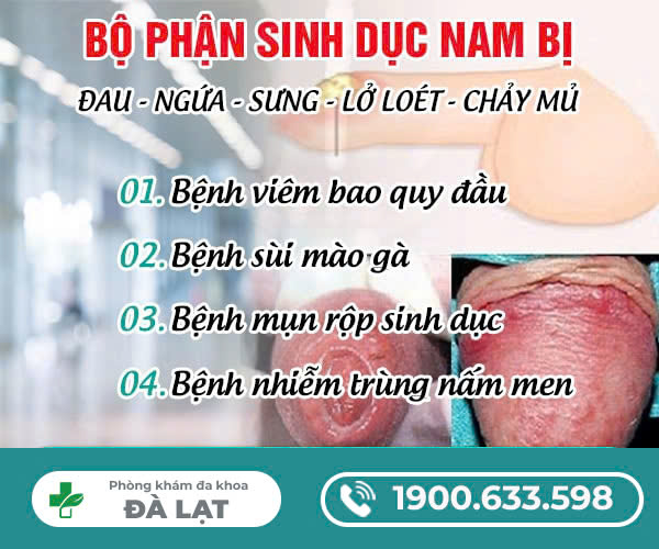Hình ảnh minh họa