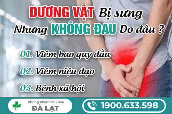 Hình ảnh minh họa