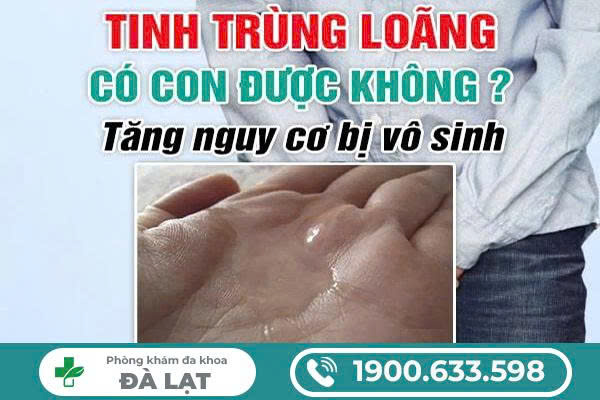 Hình ảnh minh họa