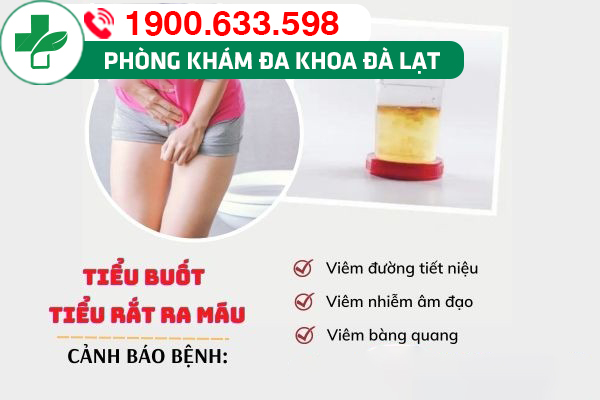 Hình ảnh minh họa
