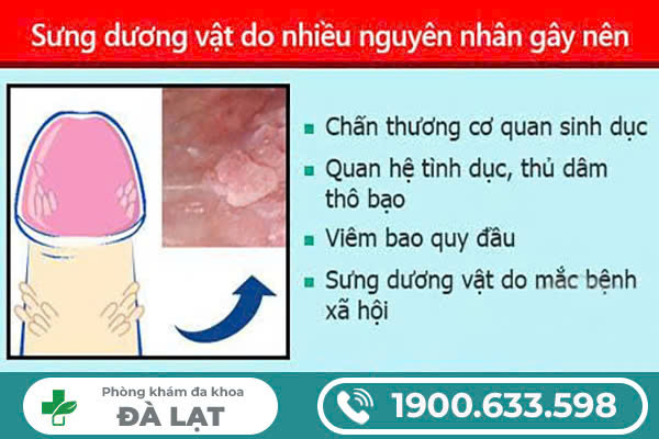 Hình ảnh minh họa