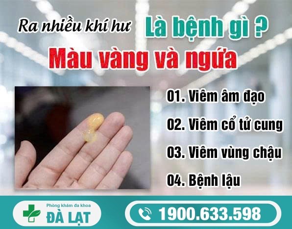 Hình ảnh minh họa