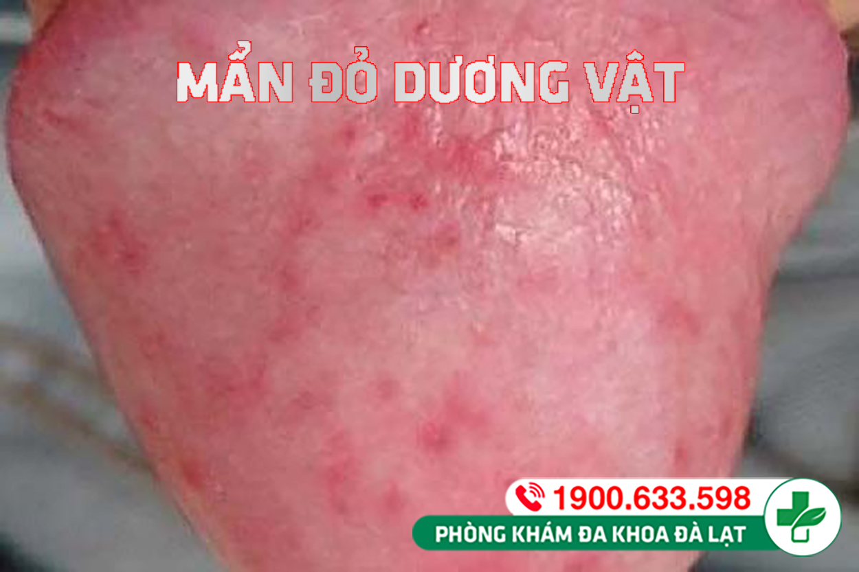 Hình ảnh minh họa