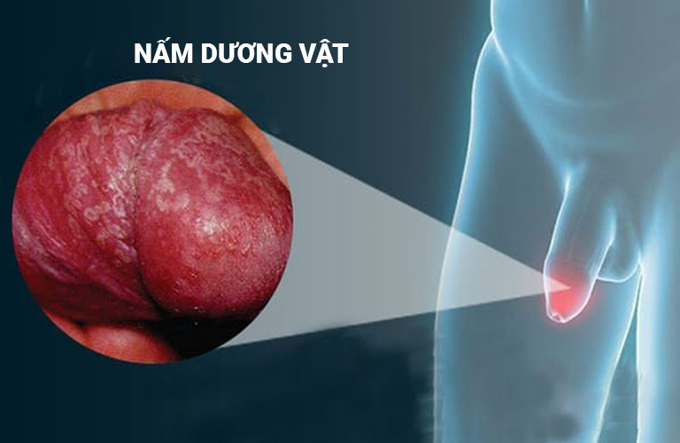 Hình ảnh minh họa