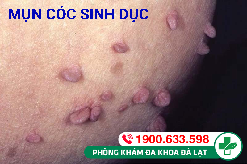 Hình ảnh minh họa