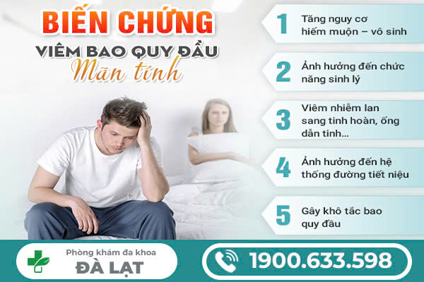 Hình ảnh minh họa