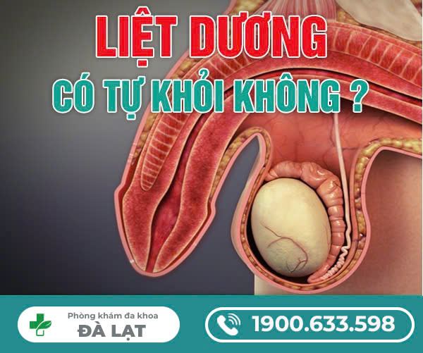 Hình ảnh minh họa