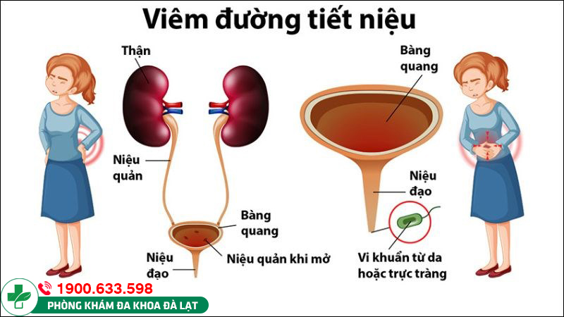 Hình ảnh minh họa