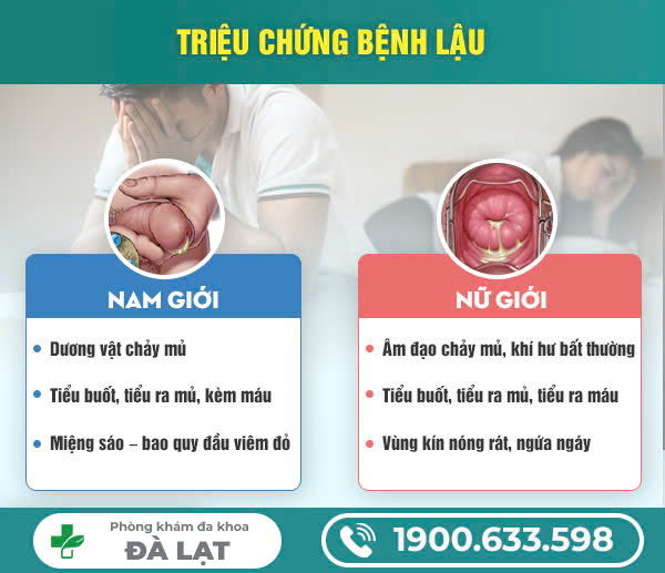 Hình ảnh minh họa