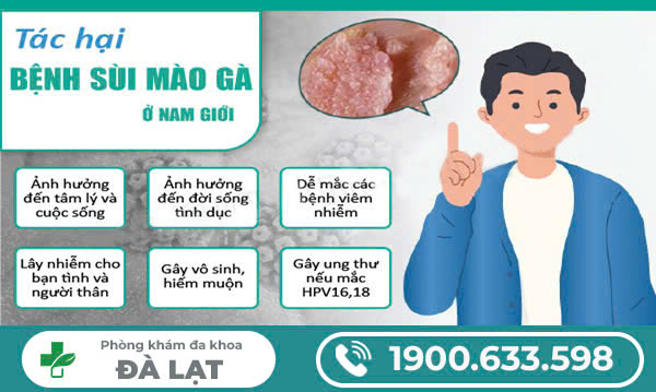 Hình ảnh minh họa