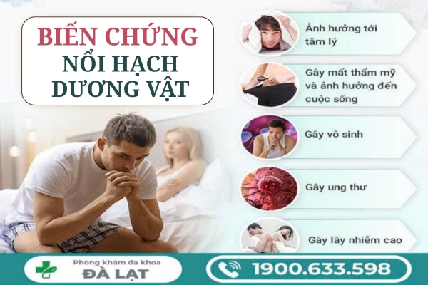 Hình ảnh minh họa