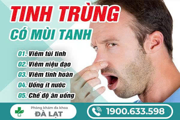 Hình ảnh minh họa