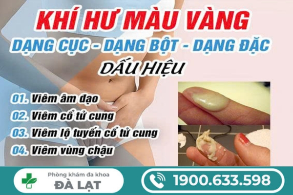 Hình ảnh minh họa