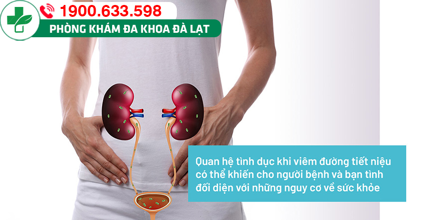Hình ảnh minh họa