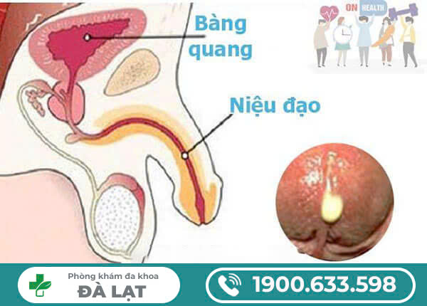 Hình ảnh minh họa