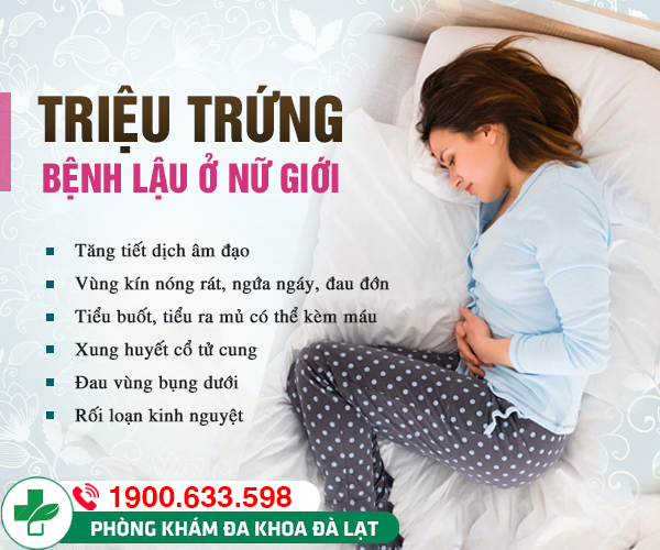 Hình ảnh minh họa