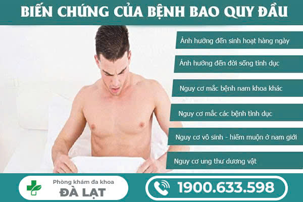 Hình ảnh minh họa