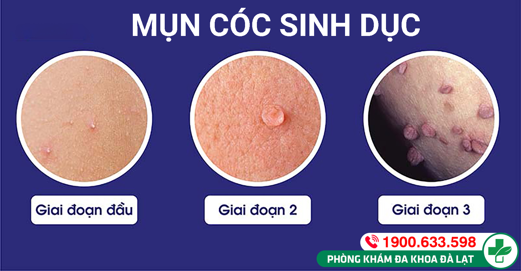 Hình ảnh minh họa