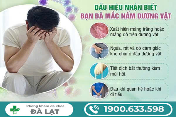 Hình ảnh minh họa