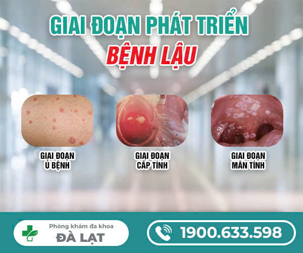 Hình ảnh minh họa