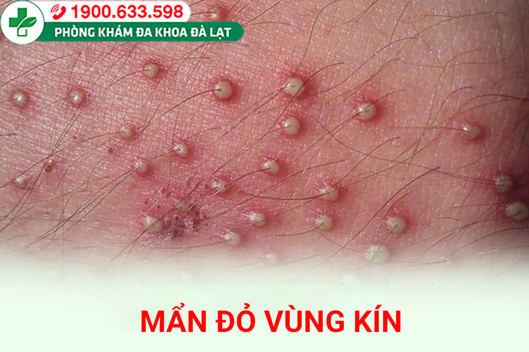 Hình ảnh minh họa