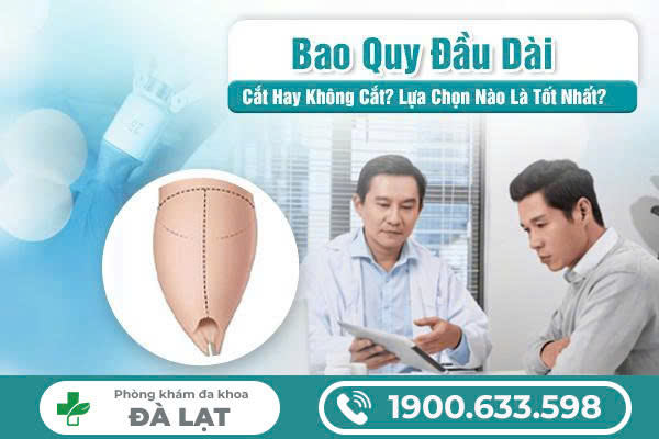 Hình ảnh minh họa