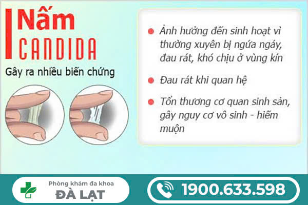 Hình ảnh minh họa