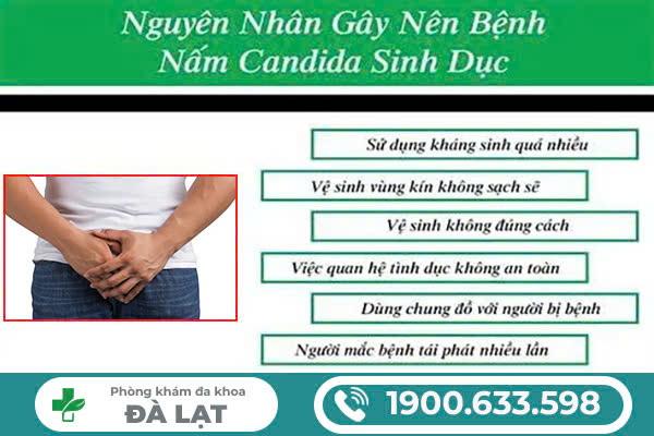 Hình ảnh minh họa