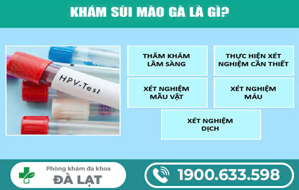 Hình ảnh minh họa