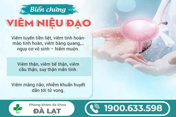 Hình ảnh minh họa