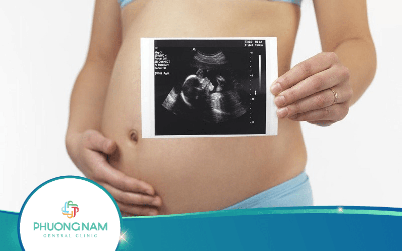 Siêu Âm 12 Tuần Tiết Lộ Điều Gì Của Thai Nhi?