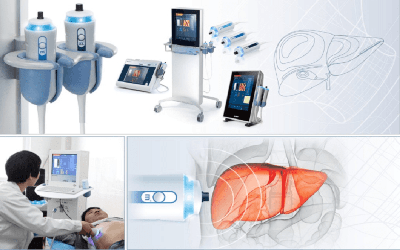 sieu-am-gan-fibroscan